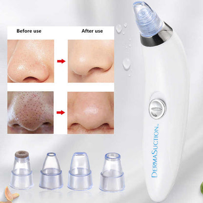 Cell Operated Pore Cleaner, Acne Tool Blackhead Remover, Nose Cleansing Beauty Instrument