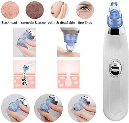 Cell Operated Pore Cleaner, Acne Tool Blackhead Remover, Nose Cleansing Beauty Instrument