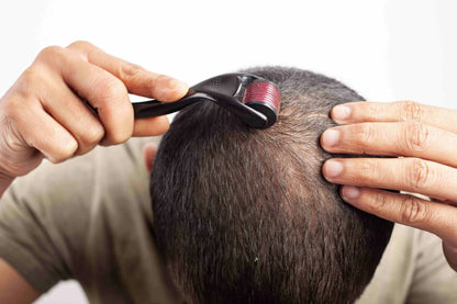 Derma Roller 0.5 Mm Hair Regrowth Beard Growth Anti Hair Loss Treatment Thinning