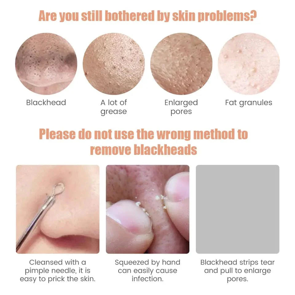 Electric Blackhead Remover, Vacuum Acne Cleaner, Black Spots Removal Device, Pore Cleaner Machine, Skin Care Tools, 5 Heads Suction Machine, Vacuum Electric Black Head Extractions Tool, Electric Facial Pore Cleaner, Exfoliating Beauty Device